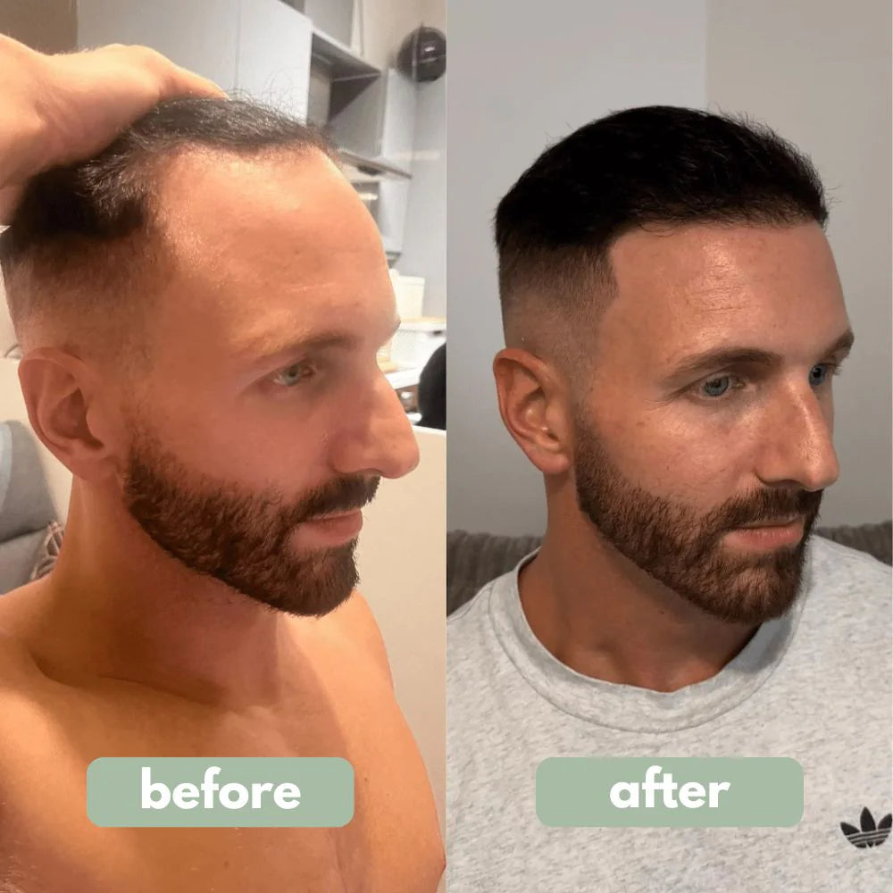 Rooted - Hair Growth Serum