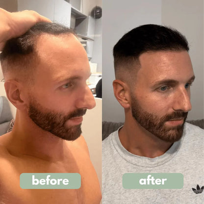 Rooted - Hair Growth Serum